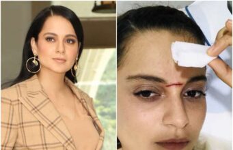 कंगना रनोट के सिर पर असली तलवार से लगी चोट, जानें- किस ने हमला ?